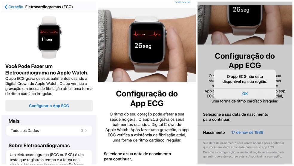 Ecg para apple hotsell watch