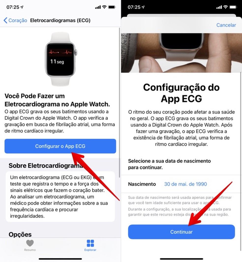 Como configurar e usar o ECG do Apple Watch