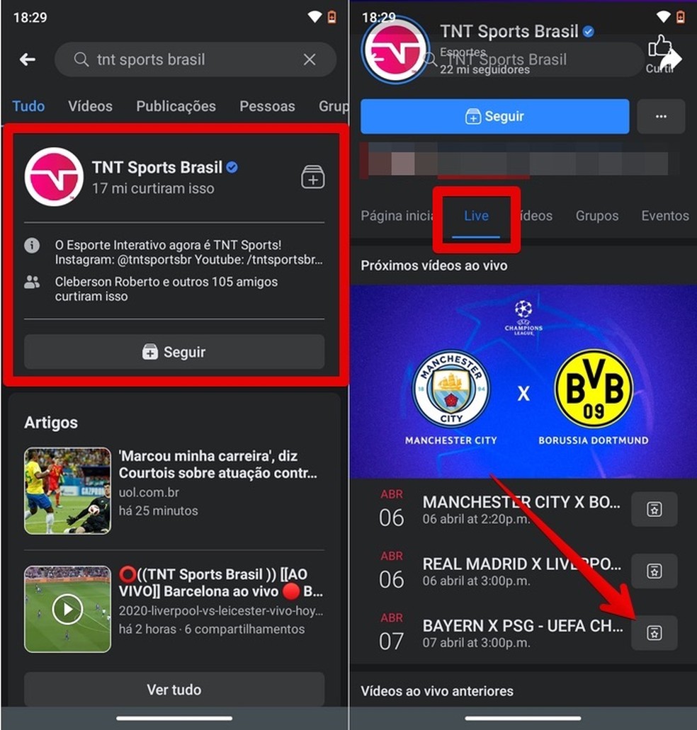 PSG x Bayern ao vivo: onde assistir ao jogo da Champions League online