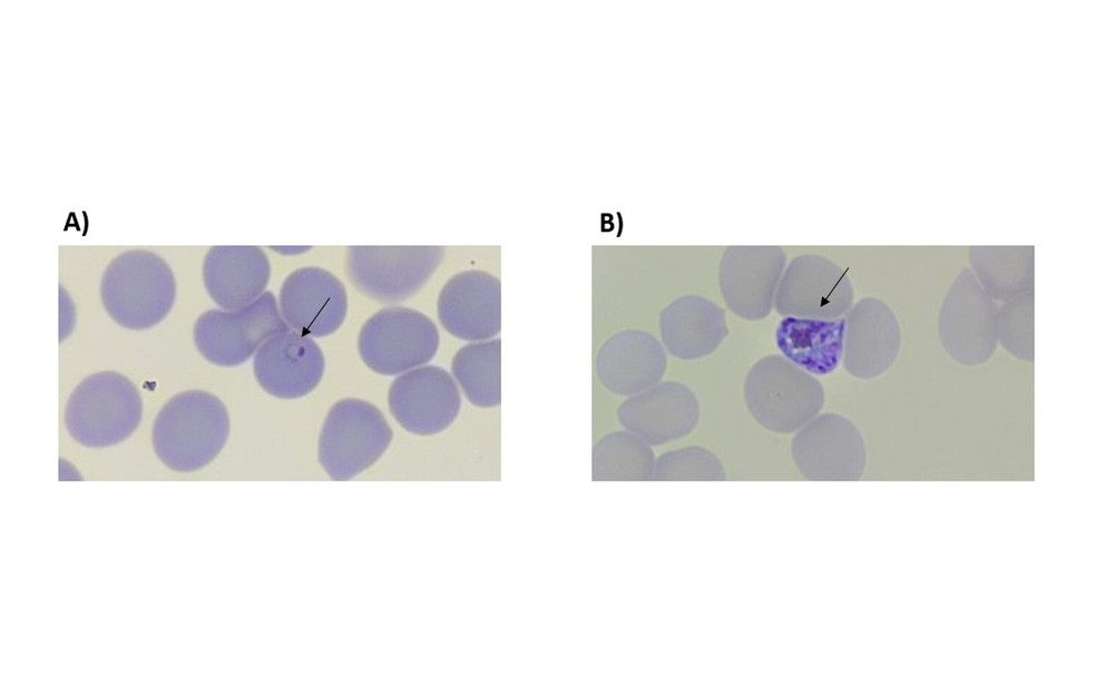 Plasmodium falsiparum, parasita causador da malária, no estágio sanguíneo assexuado — Foto: Reprodução/FAPESP (acervo dos pesquisadores)