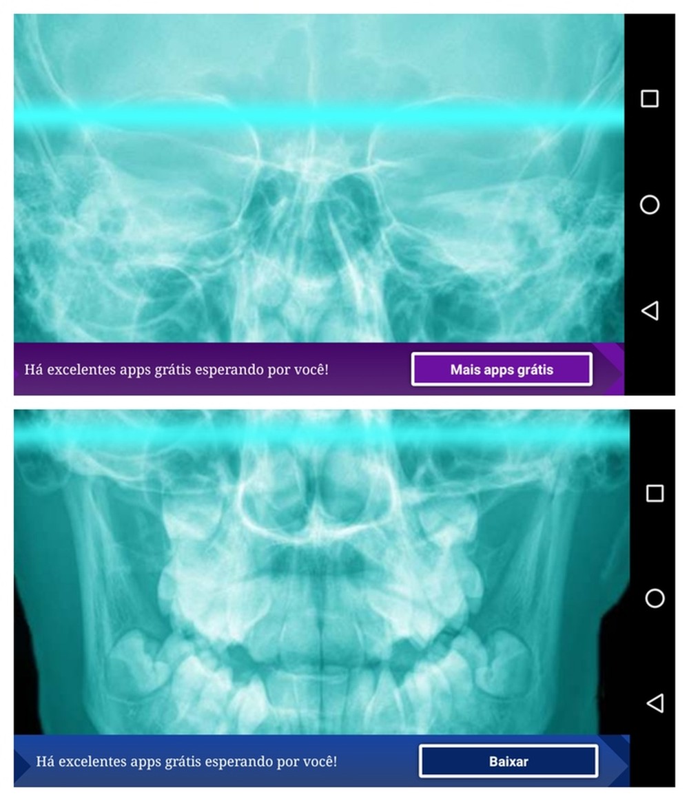 Aplicativo de raio-X: aprenda como usar para brincar com os amigos