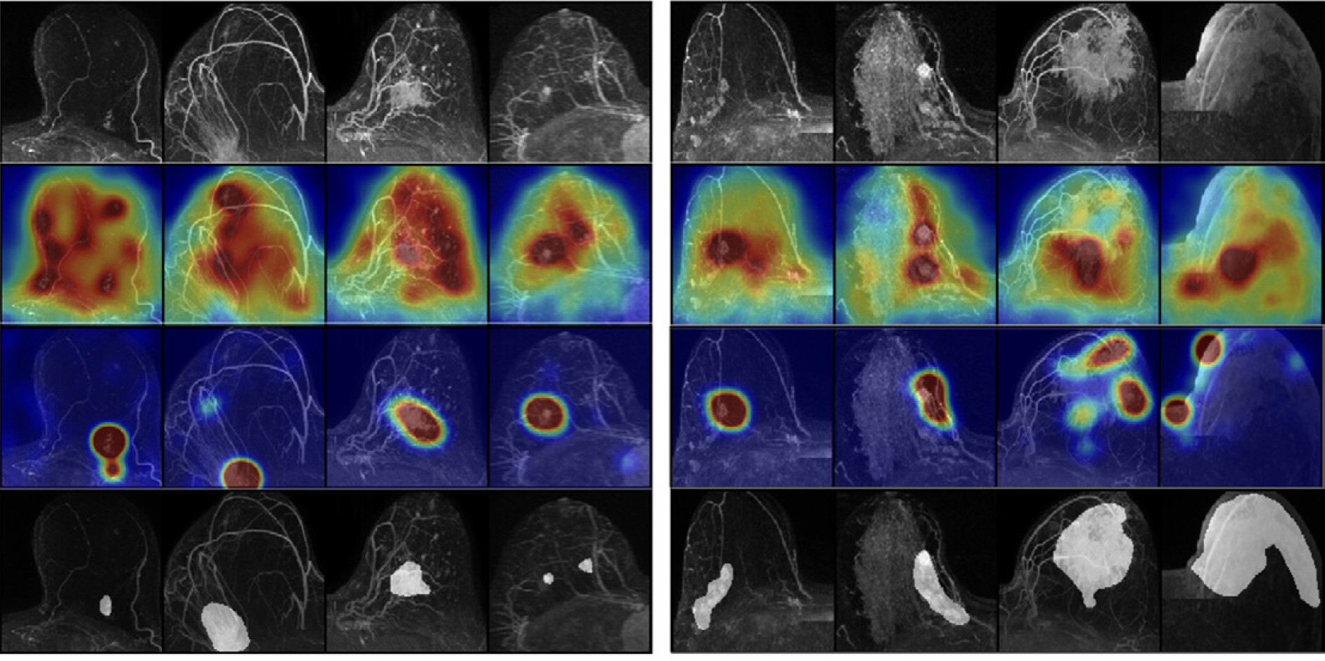 10 descobertas com IA da Microsoft que podem mudar o futuro; veja